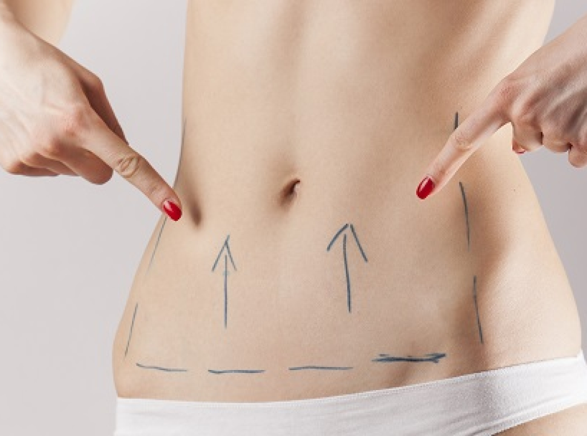 Güldüren Liposuction !
